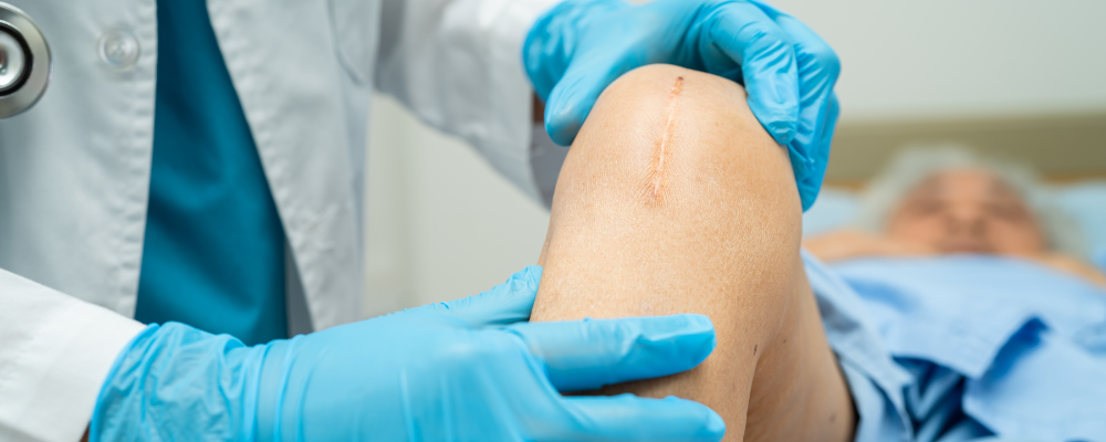 ACL Reconstruction Surgeon in Bangalore