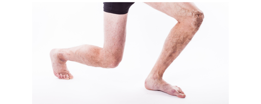 Lower limb deformity correction in Indiranagar