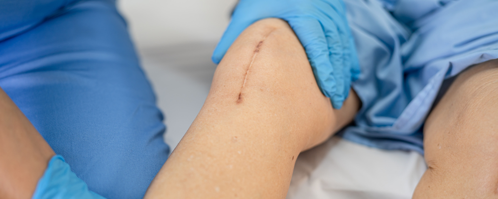 ACL Reconstruction Surgeon in Kengeri
