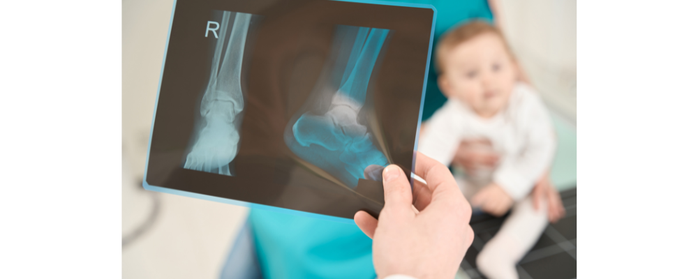 Expert Best Paediatric Orthopaedic Doctor in Nagarbhavi – Bangalore