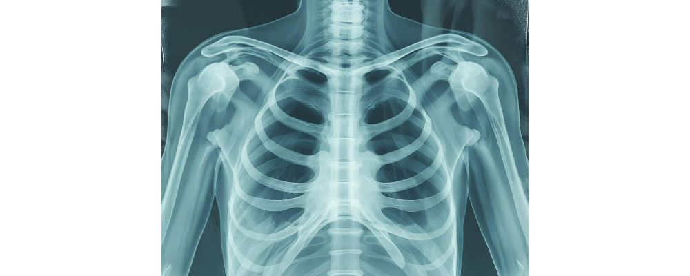 How long does shoulder fracture surgery take? Full Guide by Dr. Vijaykumar