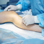 robotic knee replacement surgery Bangalore – Dr. Vijay Ortho Indiranagar