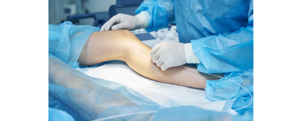 Why Bangalore Patients Are Choosing Robotic Knee Replacement Over Traditional Surgery