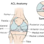 ACL Reconstruction Surgeon Bangalore performing knee evaluation